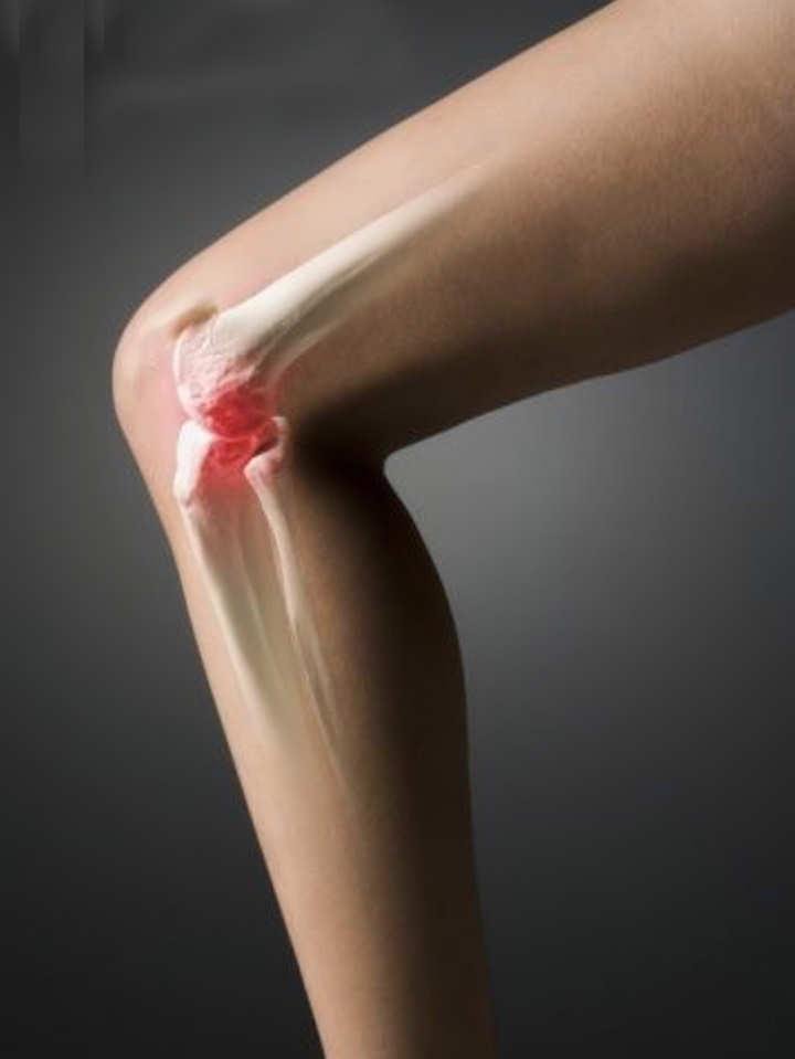 Артроз коленного сустава лечение и симптомы. Стадии, упражнения, питание при артрозе Москва
