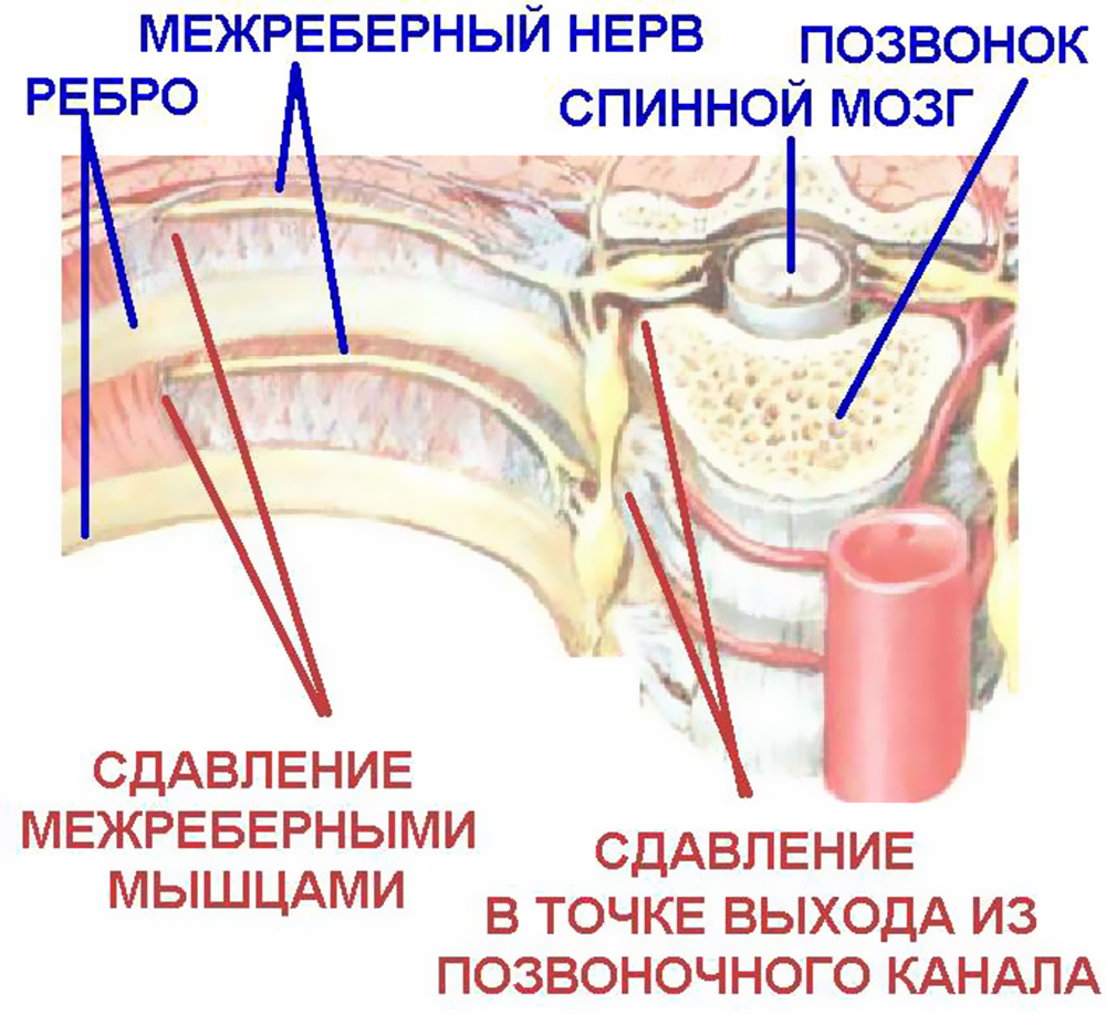 Невралгия позвоночника: причины, признаки, симптомы и лечение Москва.
