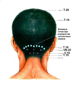 Неврит лицевого нерва: признаки, симптомы и лечение заболевания Москва