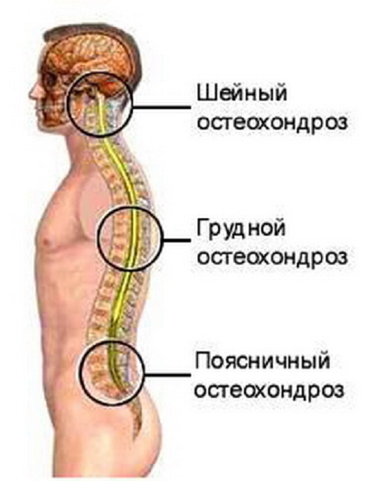 Остеохондроз позвоночника: причины, симптомы, лечение Москва.